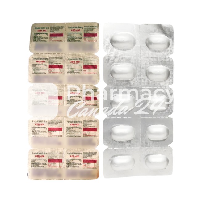 Albendazole